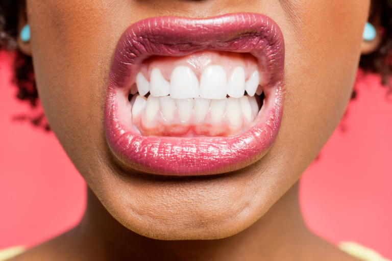 7 Reasons Why Regular Dental Check Ups Are So Essential