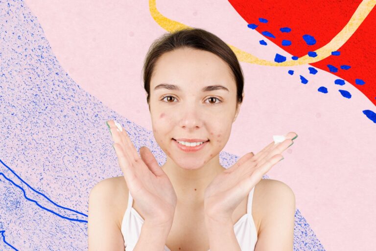 5 Popular Myths About Acne & Spots Debunked
